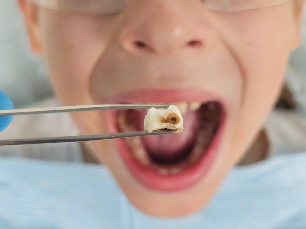 Best Cosmetic Emergency Dentistry in Charlestown, IN